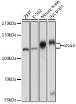 SAP102 Antibody in Western Blot (WB)