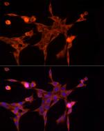 AKR1B1 Antibody in Immunocytochemistry (ICC/IF)