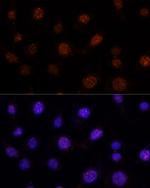 GLI2 Antibody in Immunocytochemistry (ICC/IF)