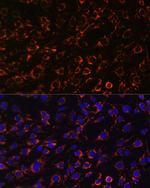 TOMM20 Antibody in Immunocytochemistry (ICC/IF)