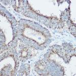 TOMM20 Antibody in Immunohistochemistry (Paraffin) (IHC (P))