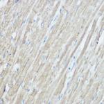 TOMM20 Antibody in Immunohistochemistry (Paraffin) (IHC (P))