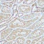 TOMM20 Antibody in Immunohistochemistry (Paraffin) (IHC (P))