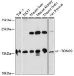 TOMM20 Antibody in Western Blot (WB)