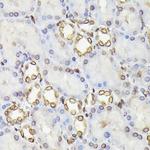 Lamin B1 Antibody in Immunohistochemistry (Paraffin) (IHC (P))