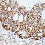 MEKK4 Antibody in Immunohistochemistry (Paraffin) (IHC (P))