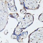 MEKK4 Antibody in Immunohistochemistry (Paraffin) (IHC (P))