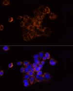 NDUFS1 Antibody in Immunocytochemistry (ICC/IF)