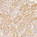 NDUFS1 Antibody in Immunohistochemistry (Paraffin) (IHC (P))