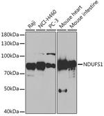 NDUFS1 Antibody in Western Blot (WB)