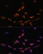 PAK3 Antibody in Immunocytochemistry (ICC/IF)