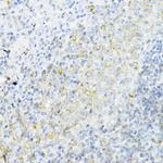 AMPK alpha-1 Antibody in Immunohistochemistry (Paraffin) (IHC (P))