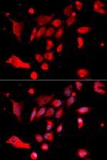 MAD2 Antibody in Immunocytochemistry (ICC/IF)