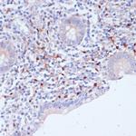 WIPF1 Antibody in Immunohistochemistry (Paraffin) (IHC (P))