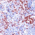 WIPF1 Antibody in Immunohistochemistry (Paraffin) (IHC (P))