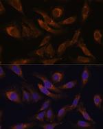 SOCS2 Antibody in Immunocytochemistry (ICC/IF)