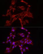 DNM1L Antibody in Immunocytochemistry (ICC/IF)