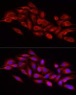 DNM1L Antibody in Immunocytochemistry (ICC/IF)