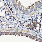 YAP1 Antibody in Immunohistochemistry (Paraffin) (IHC (P))