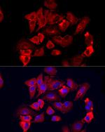 MMP12 Antibody in Immunocytochemistry (ICC/IF)