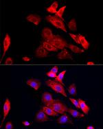 MMP12 Antibody in Immunocytochemistry (ICC/IF)