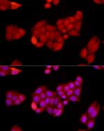 SIRT1 Antibody in Immunocytochemistry (ICC/IF)