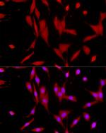 SIRT1 Antibody in Immunocytochemistry (ICC/IF)