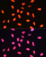 DNMT1 Antibody in Immunocytochemistry (ICC/IF)