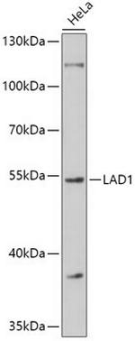 LAD1 Antibody in Western Blot (WB)