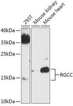 C13orf15 Antibody in Western Blot (WB)