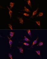 GNPNAT1 Antibody in Immunocytochemistry (ICC/IF)