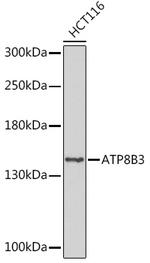 ATP8B3 Antibody in Western Blot (WB)