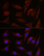 PKC Pan Antibody in Immunocytochemistry (ICC/IF)