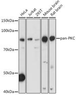 PKC Pan Antibody in Western Blot (WB)