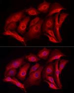 MCL-1 Antibody in Immunocytochemistry (ICC/IF)