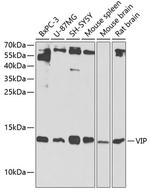 VIP Antibody in Western Blot (WB)