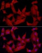 PTPN2 Antibody in Immunocytochemistry (ICC/IF)