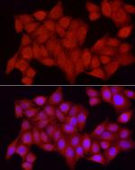 PTPN2 Antibody in Immunocytochemistry (ICC/IF)