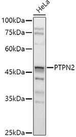 PTPN2 Antibody in Western Blot (WB)