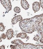 BAP1 Antibody in Immunohistochemistry (Paraffin) (IHC (P))