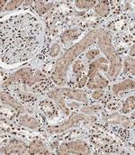 BAP1 Antibody in Immunohistochemistry (Paraffin) (IHC (P))