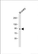 BAP1 Antibody in Western Blot (WB)