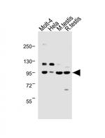 BAP1 Antibody in Western Blot (WB)