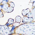 Fyn Antibody in Immunohistochemistry (Paraffin) (IHC (P))