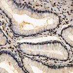 CSB Antibody in Immunohistochemistry (Paraffin) (IHC (P))