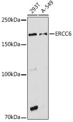 CSB Antibody in Western Blot (WB)