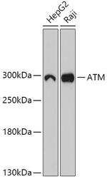 ATM Antibody in Western Blot (WB)