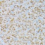 p130Cas Antibody in Immunohistochemistry (Paraffin) (IHC (P))