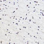 GTF3C3 Antibody in Immunohistochemistry (Paraffin) (IHC (P))