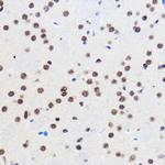 GTF3C3 Antibody in Immunohistochemistry (Paraffin) (IHC (P))